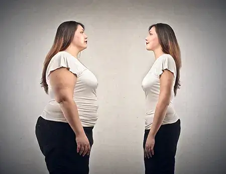 Before and after weight- loss results of an Vivaslim user